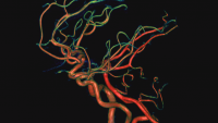 3D image of arteries